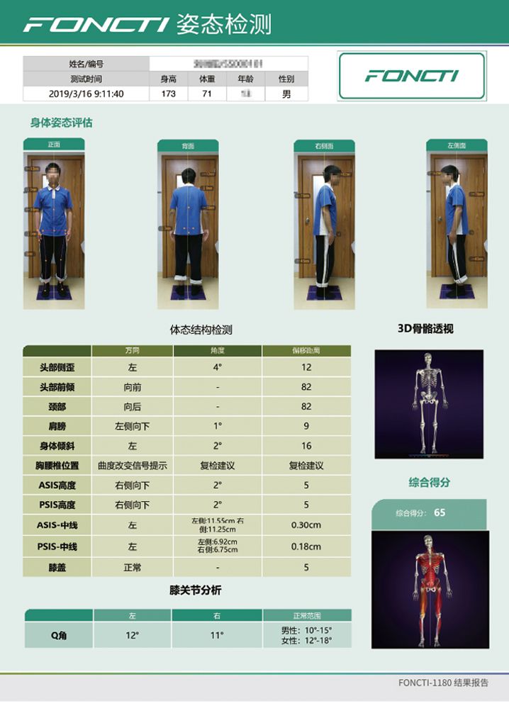 步態(tài)分析系統(tǒng)產品報告