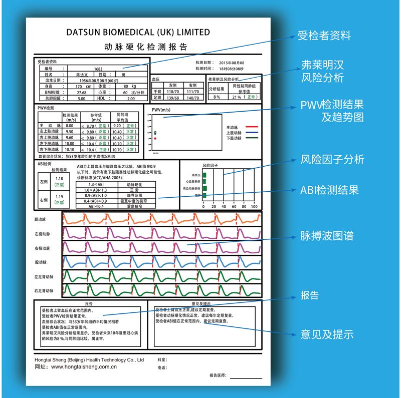 動(dòng)脈硬化檢測(cè)儀