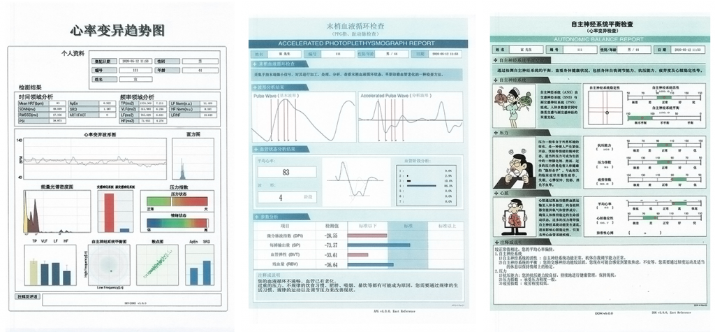 精神壓力分析儀