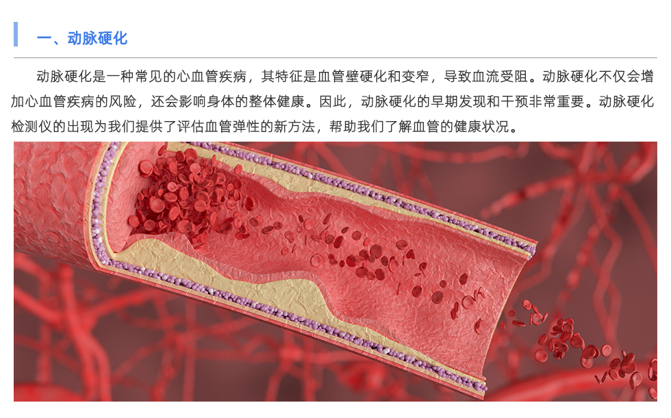 動(dòng)脈硬化檢測(cè)儀