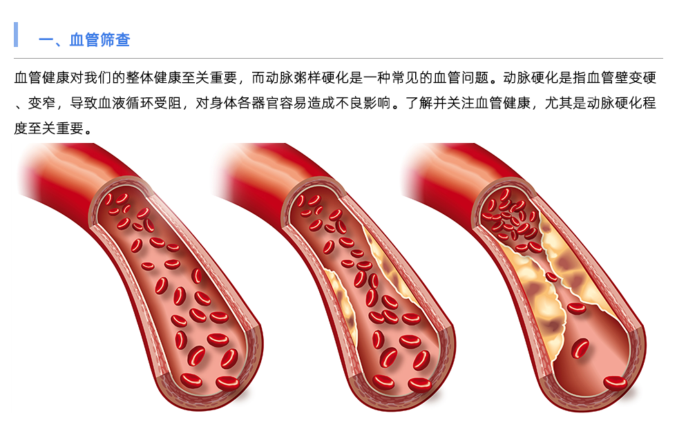 動脈硬化檢測儀