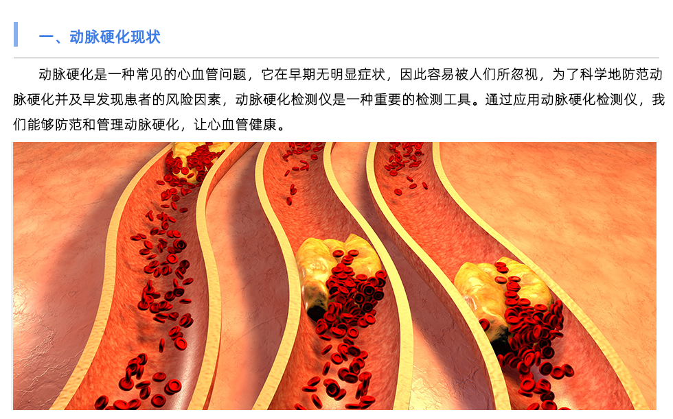 動脈硬化檢測儀