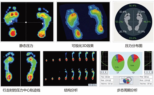 足底壓力分析儀