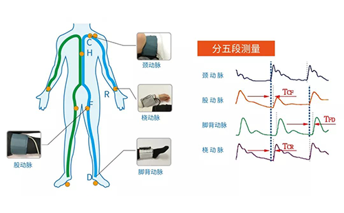 動(dòng)脈硬化檢測(cè)儀