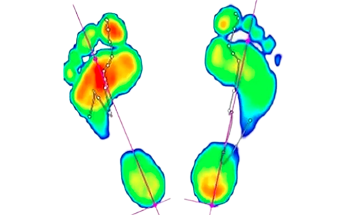 足底壓力檢測(cè)儀
