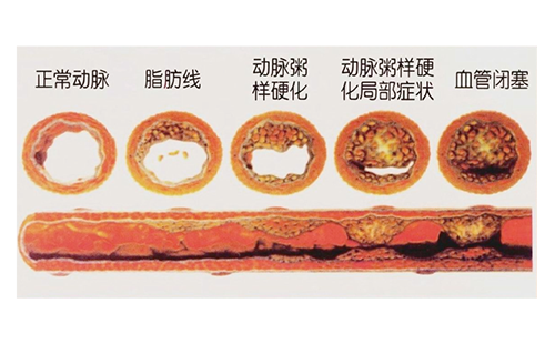 脈搏波速測(cè)定儀