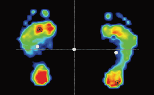 足底壓力分析系統(tǒng)
