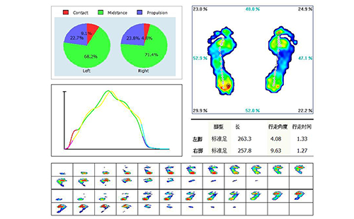 足底壓力測(cè)試儀