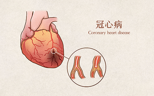 動(dòng)脈硬化分析儀