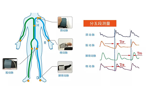 脈搏波速測定儀